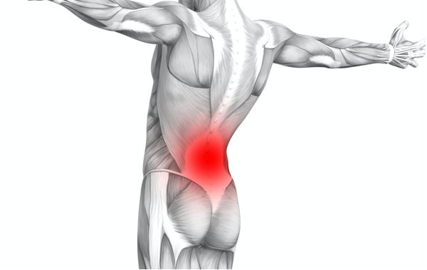 Facet joint arthritis causing back pain