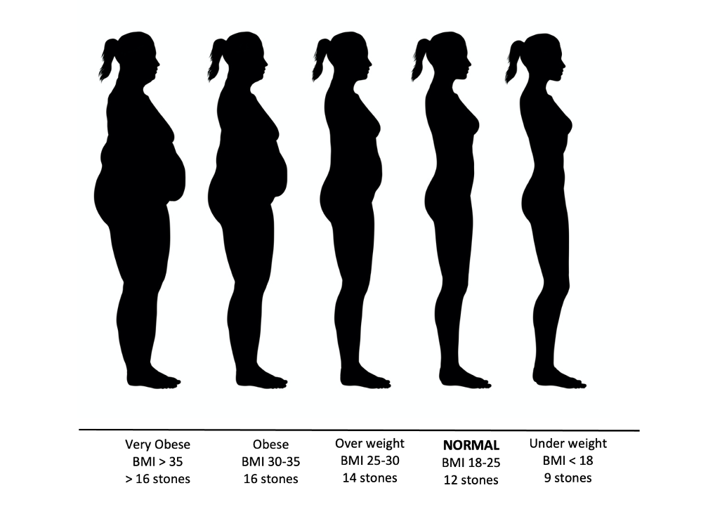 Weight gain in Women causes Back pain