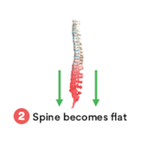 Bed Rest | Spine becomes flat and weak| Mangattil rajesh | Spine Surgeon London